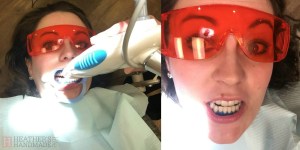 White teeth without a filter: My teeth whitening experience {Heather's Handmade Life}
