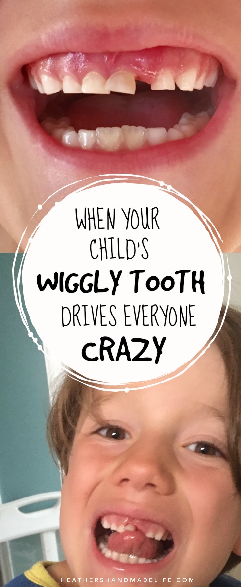 When your child's wiggly tooth drives you CRAZY {Heather's Handmade Life}
