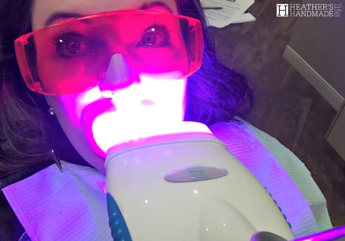 White teeth without a filter: My teeth whitening experience {Heather's Handmade Life}
